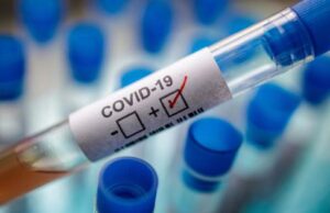 Coronavirus, positivi in forte aumento: 452 gli attuali casi