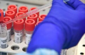 Covid-19 in Puglia: 3 positivi nel leccese. 1 decesso nella provincia di Bari