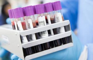Coronavirus, in crescita il numero dei contagi: 36 positivi