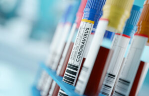 Coronavirus in Puglia: sono 20 i nuovi casi. Nessun decesso