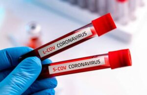 Coronavirus, in calo il numero dei casi: 324 gli attualmente positivi