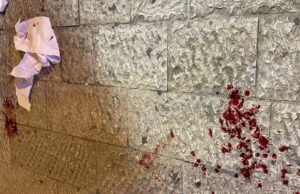 Violenta aggressione: giovane  preso a calci e pugni in via San Benedetto