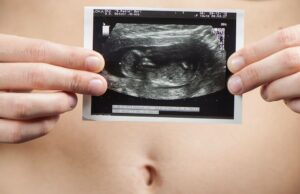 PD e GD di Corato a favore del Social Freezing: una rivoluzione per la salute riproduttiva femminile